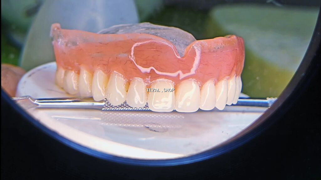 🔥 YALNIZ 7 GÜN! XÜSUSİ KAMPANİYA 🔥 🦷 Yüksək keyfiyyətli vakuum protez
